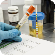 DRUG TESTING